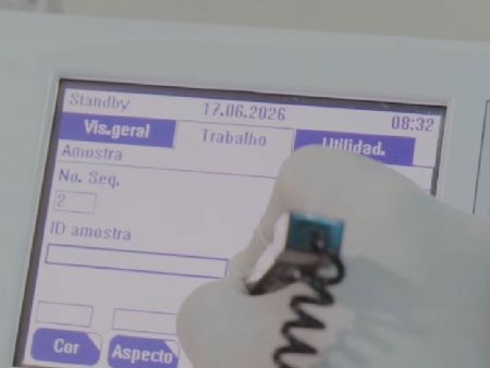 Programa Nacional de Controle de Qualidade (PNCQ)